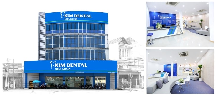 Kim Dental là một trong những địa chỉ cấy ghép răng Implant uy tín, được tin cậy tại TP HCM